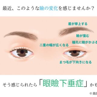 眼瞼下垂の極意　手術　参考書　医学書 動画＆イラスト＆写真でわかる眼瞼手術の極意 advance：誰でも