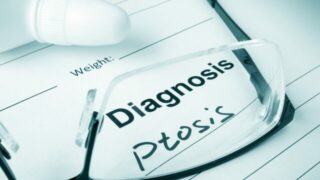 眼瞼下垂に「医療用テープ（サージカルテープ）」「アイテープ」は効く？──効果・限界・悪化リスク・正しい使い方まで専門医が徹底解説