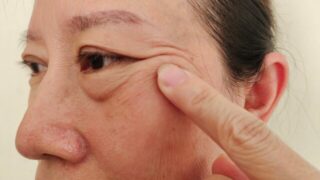 軽度眼瞼下垂とは？原因・症状・治し方まで眼瞼下垂専門医が徹底解説