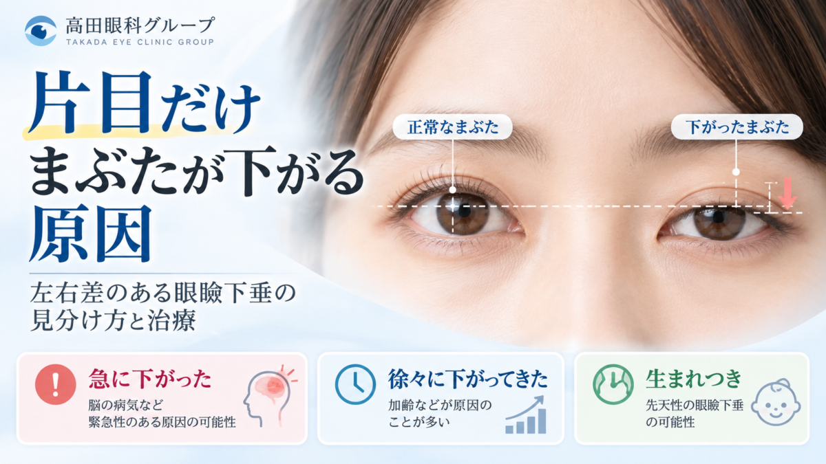 片目だけまぶたが下がる原因と眼瞼下垂の左右差を解説するイメージ