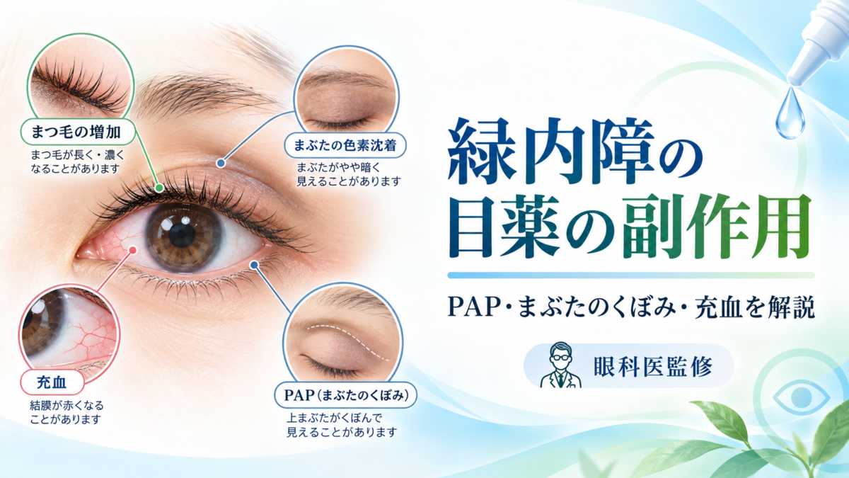 緑内障の目薬の副作用を解説するイラスト。まつ毛の増加、まぶたの色素沈着、充血、PAPによる上まぶたのくぼみを紹介