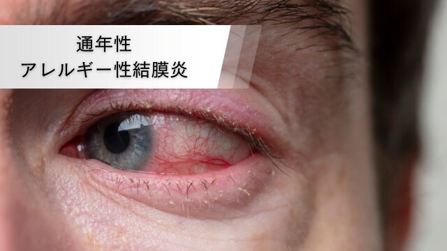 アレルギー性結膜炎は伝染性ですか?