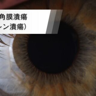 蚕食性角膜潰瘍（モーレン潰瘍） - 浜松市の高田眼科