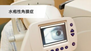 水疱性角膜症 - 眼瞼下垂手術＆二重切開手術専門｜Takada Eye Health Group