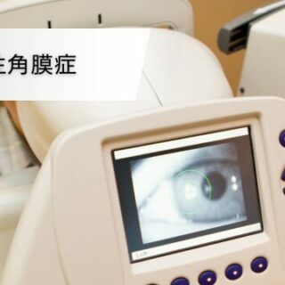 水疱性角膜症 - 浜松市の高田眼科