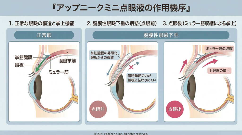 後天性眼瞼下垂に対するアップニークミニ点眼液の作用機序を示した図。正常眼、点眼前、点眼後を比較し、ミュラー筋の収縮による上眼瞼挙上を示す
