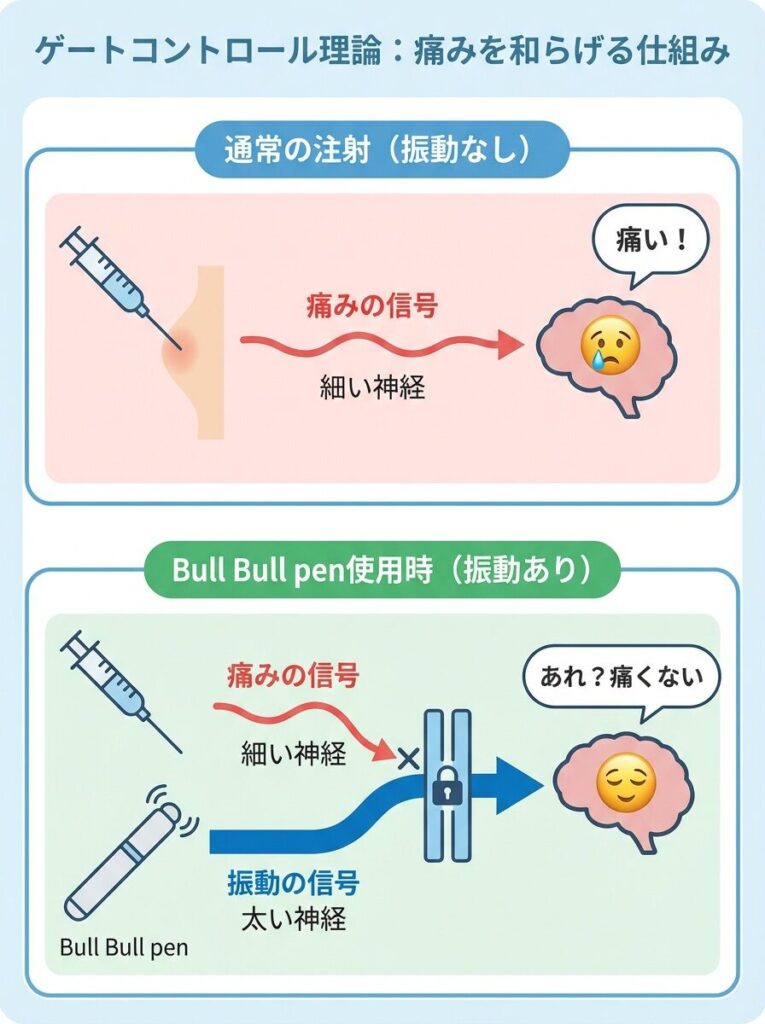 ゲートコントロール理論による振動刺激での痛み軽減メカニズムを説明した図解