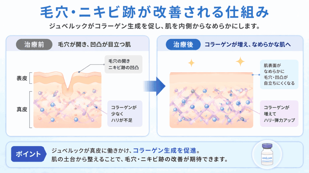 毛穴・ニキビ跡が改善される仕組み