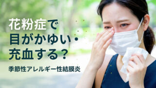 花粉症で目がかゆい・充血する原因は？季節性アレルギー性結膜炎の症状と治療法を眼科医が解説