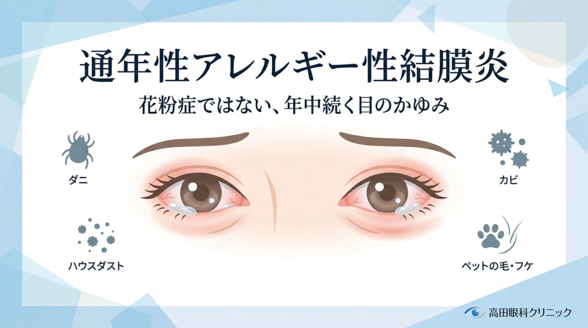 通年性アレルギー性結膜炎の記事用アイキャッチ画像。かゆみや充血のある目元と、ダニ・ハウスダスト・カビ・ペット由来のアレルゲンをイメージした医療イラスト