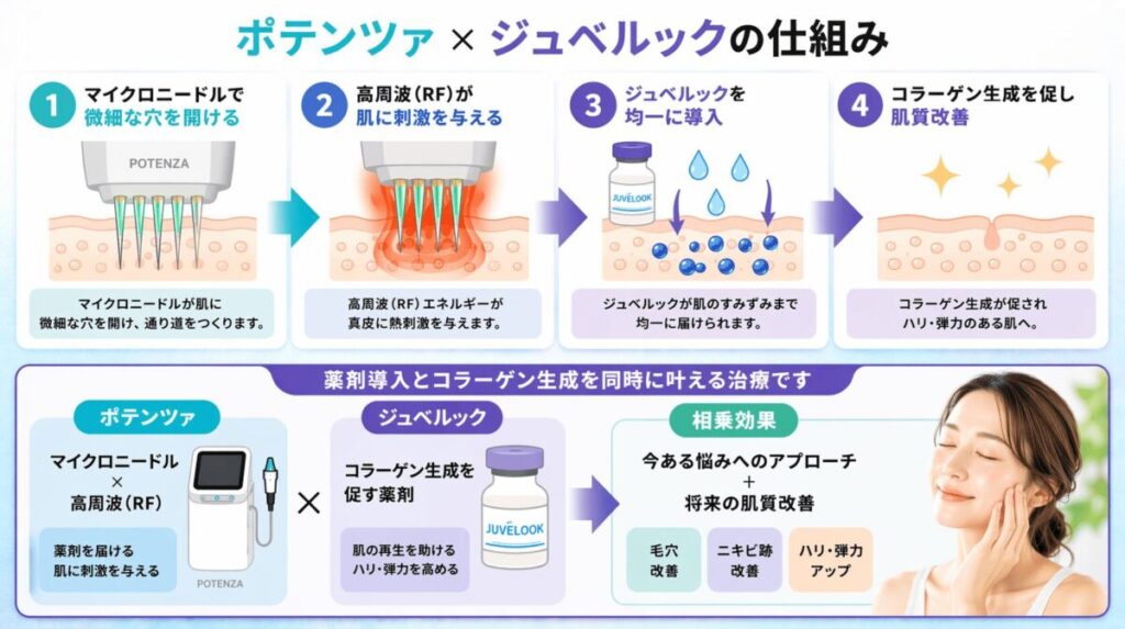 ポテンツァ×ジュベルックは薬剤導入とコラーゲン生成を同時に行う治療