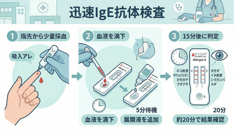 指先から少量採血し、血液を滴下して展開液を加え、約20分で結果を確認する迅速IgE抗体検査の流れを示した眼科ブログ用イラスト