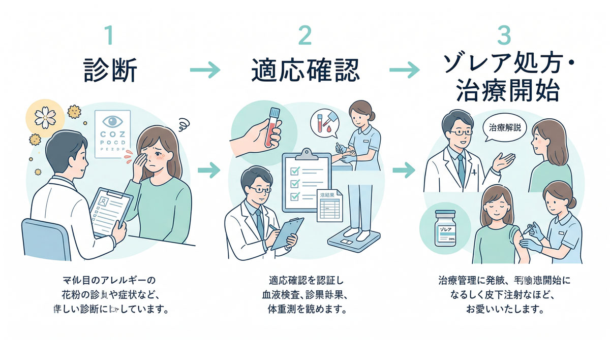 診断、適応確認、ゾレア処方・治療開始の流れを示した花粉症治療の医療イラスト