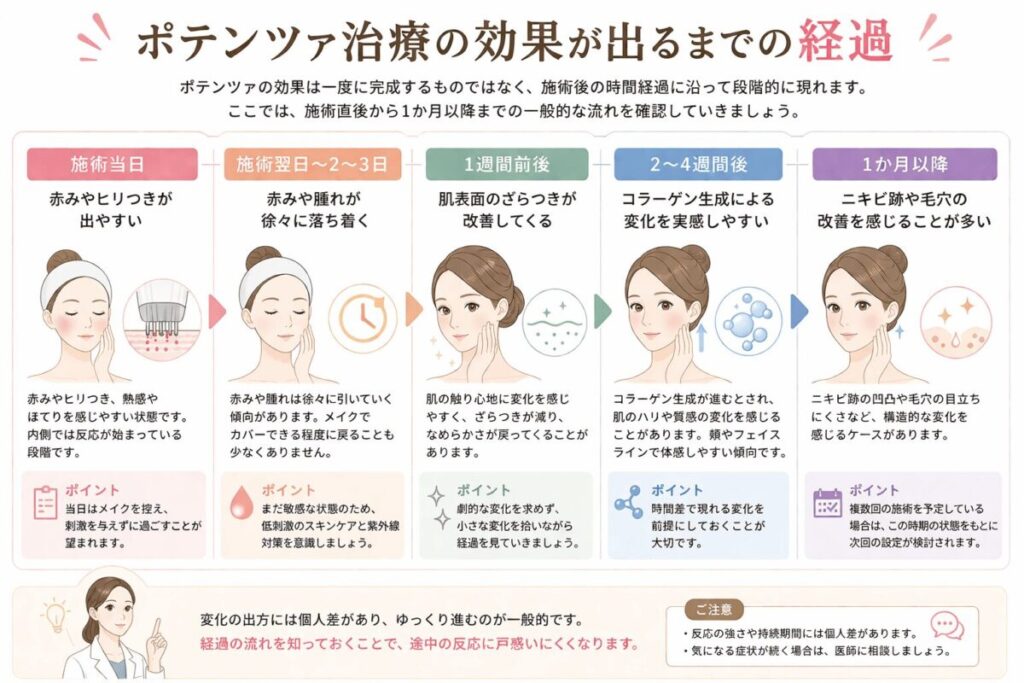 ポテンツァ治療の効果が出るまでの経過